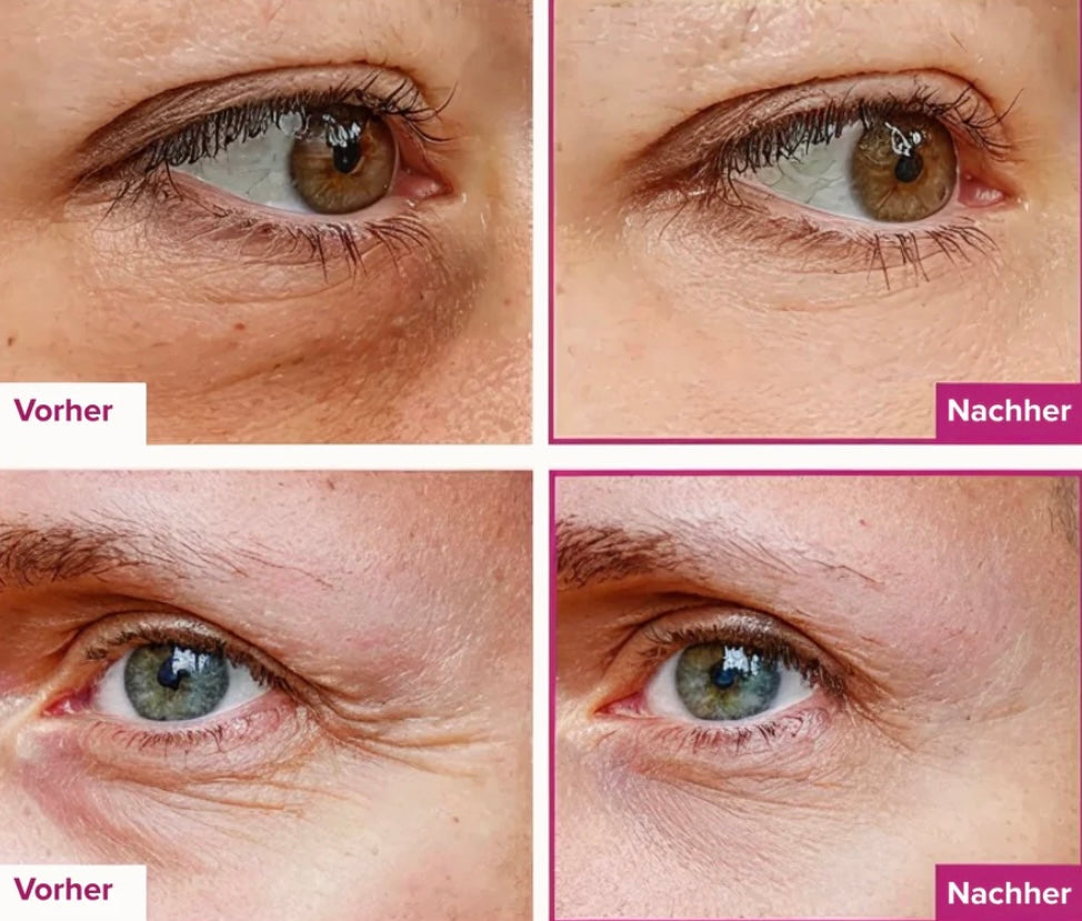 Collagen Calcium Moisturizing Stick - Reduziert Augenringe sichtbar
