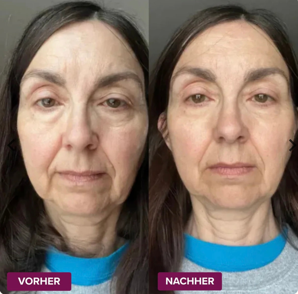 Collagen Calcium Moisturizing Stick - Reduziert Augenringe sichtbar